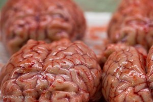Brains